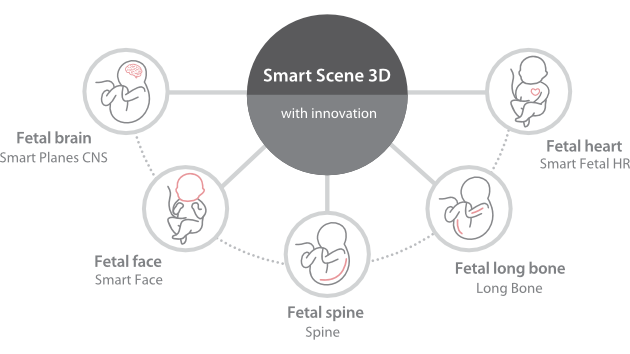 Smart Scene 3D: интеллектуальная 3D-визуализация для точной пренатальной диагностики.